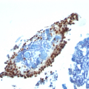 p21WAF1 (Tumor Suppressor Protein); Clone HJ21 (Concentrate)